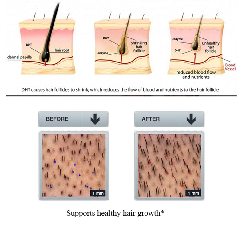 Shampoo and Conditioner for Hair Growth Prevent Hair Loss