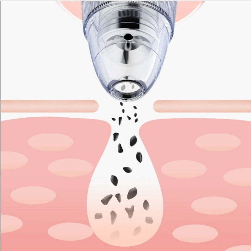 Facial Blackhead Remover Electric Pore Cleaner